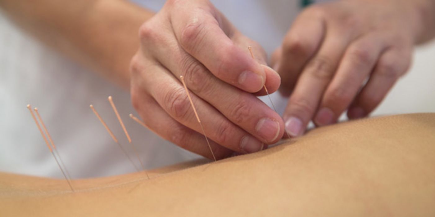 Akupunktur hilft auch Kindern, Schmerzen zu lindern.