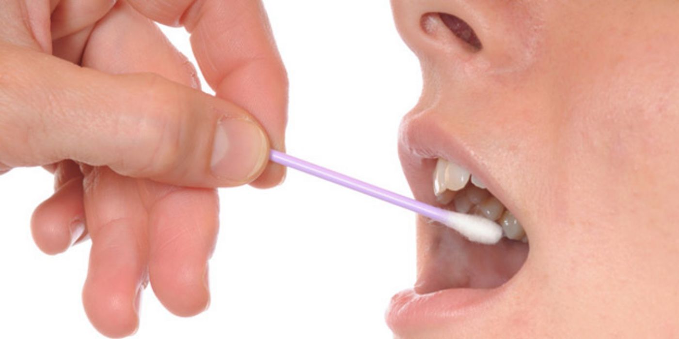 Spezielle Bakterien im Mund geben Hinweise auf Krebs.