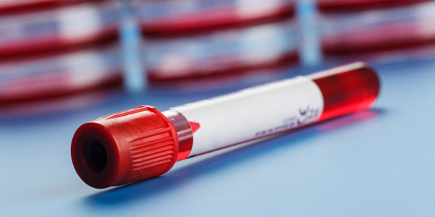 Teströhrchen mit Blut