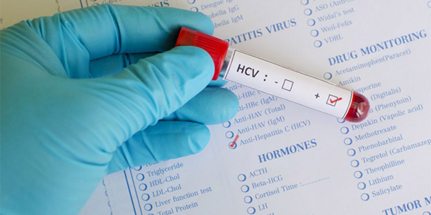 Hepatitis C wird über infiziertes Blut übertragen.