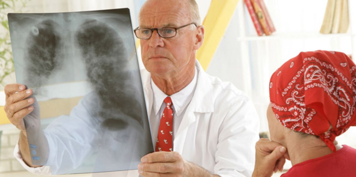 Krebspatientin mit Kopftuch sitzt neben Arzt, der ein Röntgenbild ihres Brustkorbs gegens Licht hält