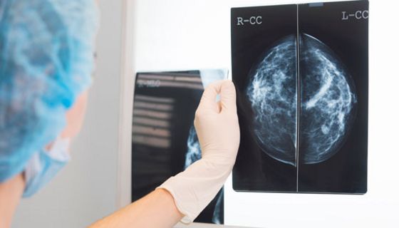 Ein Google-Programm schlägt Ärzte bei der Diagnose von Brustkrebs.