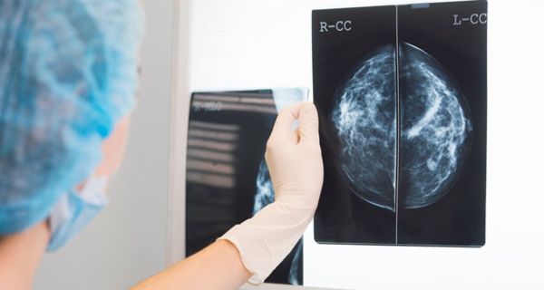 Ein Google-Programm schlägt Ärzte bei der Diagnose von Brustkrebs.