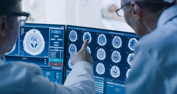 Ärzte untersuchen MRT-Aufnahmen von einem Gehirn.