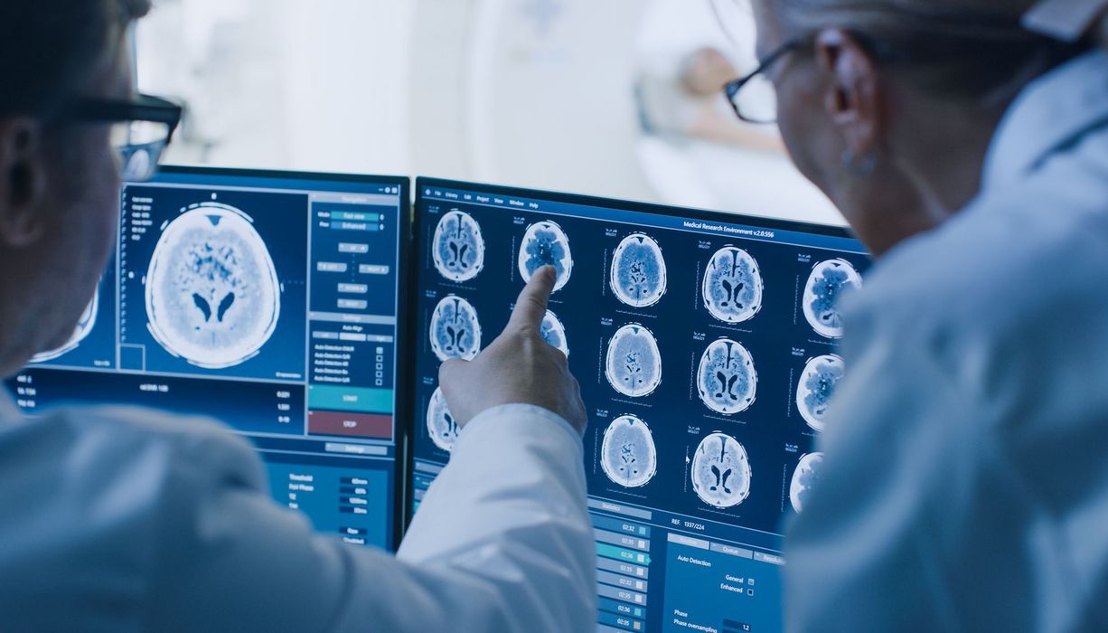 Ärzte untersuchen MRT-Aufnahmen von einem Gehirn.