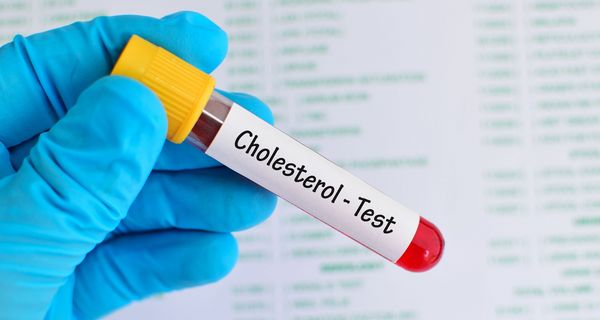 Foto von Blutröhrchen mit der Aufschrift "Cholesterol-Test".