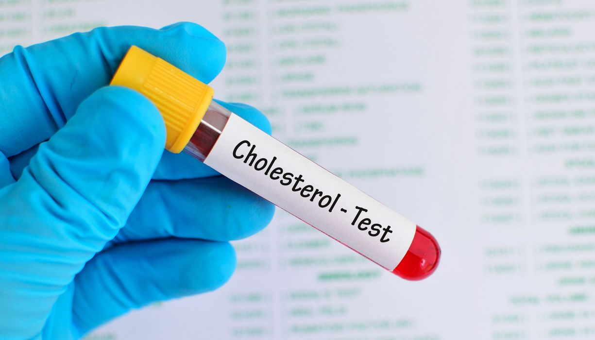 Foto von Blutröhrchen mit der Aufschrift "Cholesterol-Test".