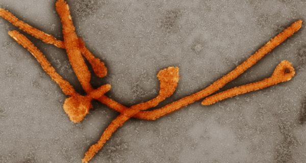 Das Ebolavirus in 10.000-facher Vergrößerung.