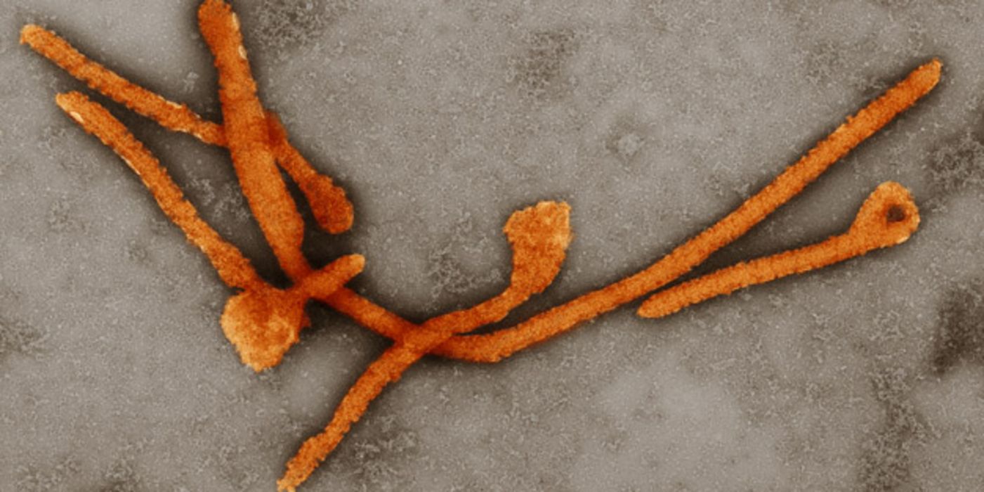 Das Ebolavirus in 10.000-facher Vergrößerung.