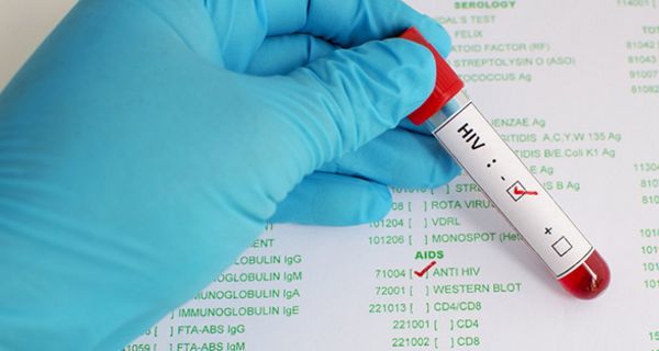 Die Zahl der HIV-Neuinfektionen bleibt in Deutschland stabil.