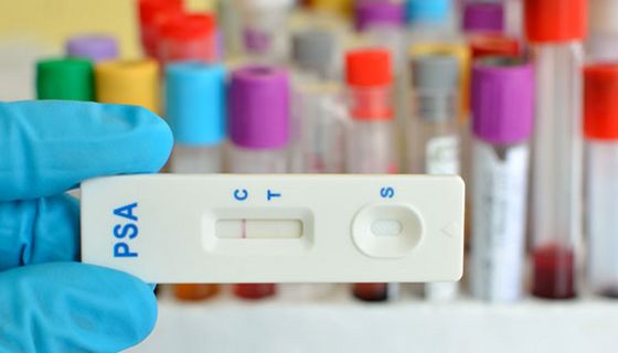 Die Prostatakrebs-Früherkennung ist ausbaufähig.