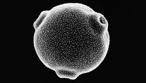 Elektronenmikroskopische Aufnahme eines Birkenpollens