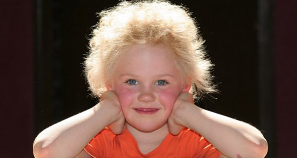 Forscher haben die Struwwelpeter-Gen entdeckt.