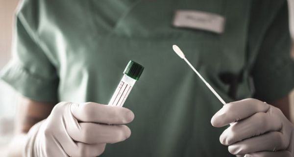 Künftig sollen mehr Menschen auf Covid-19 getestet werden.