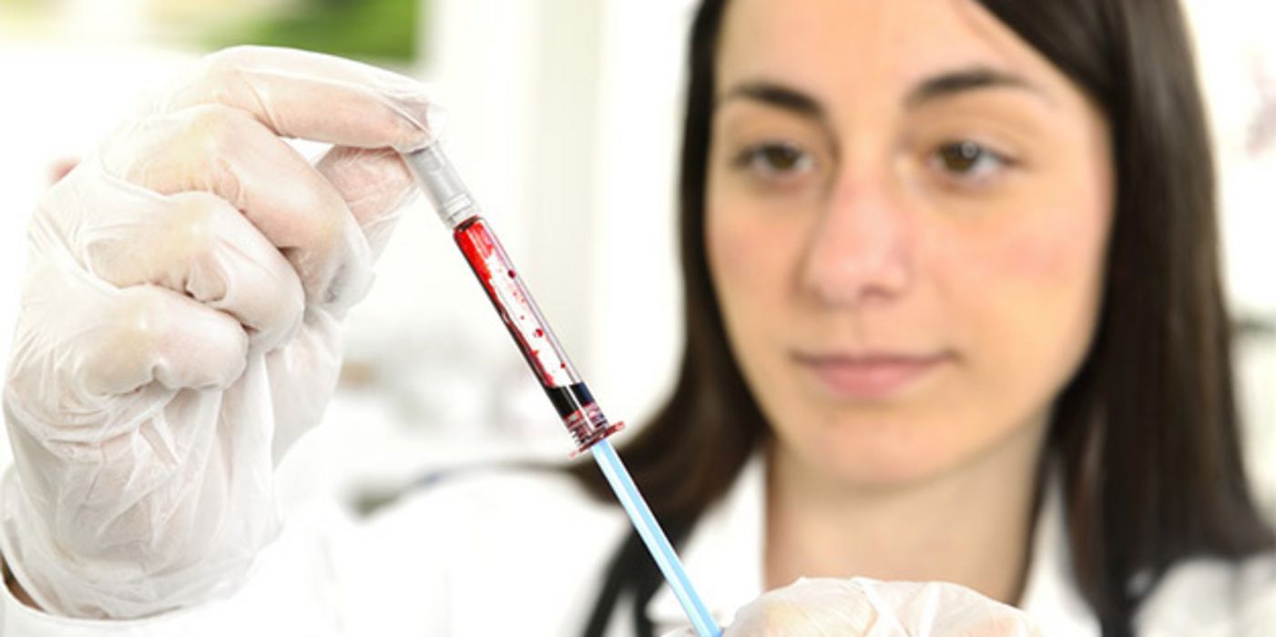 HIV und Hepatitis C häufiger testen