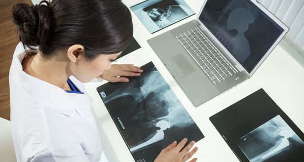 Ärztin betrachtet Röntgenaufnahme, auf der ein künstliches Hüftgelenk sichtbar ist.