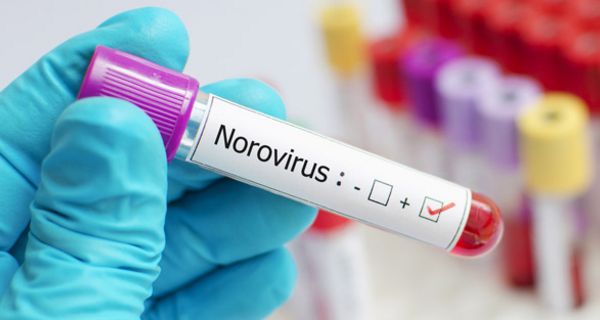 Forscher tüfteln an einer Impfung gegen Noroviren.
