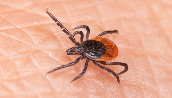 Zecke auf menschlicher Haut.