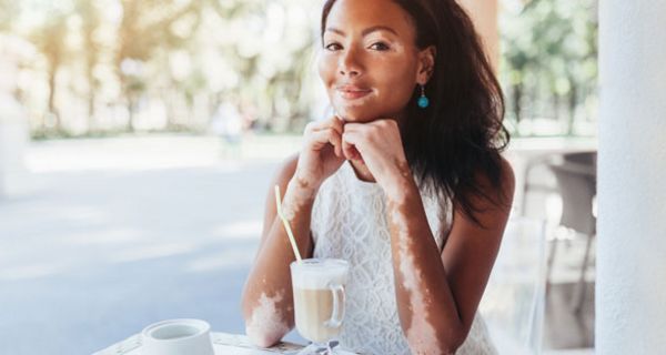 Die Haut von Vitiligo-Patienten ist besonders empfindlich.