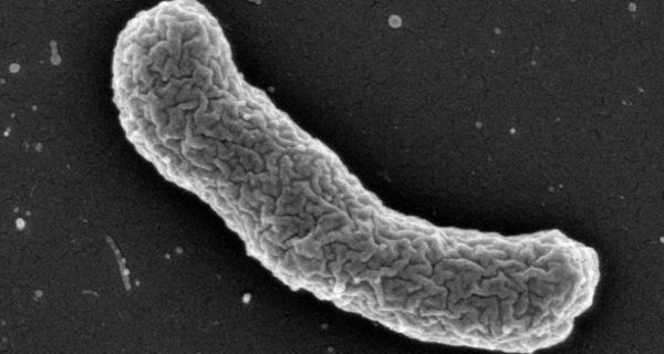 Elektronenmikroskopische Aufnahme des Teixobactin-Produzenten Elefhtheria terrae