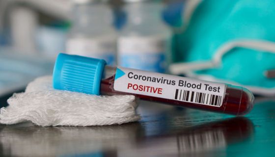 Vier Erkrankungsfälle des Coronavirus sind bekannt.