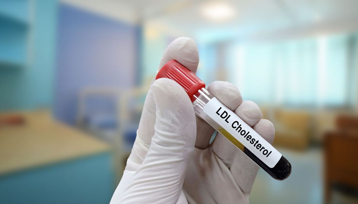 Blutprobenröhrchen mit der Aufschrift LDL-Cholesterin.