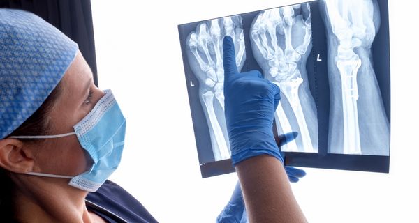 Ärztin, begutachtet Röntgenbild.