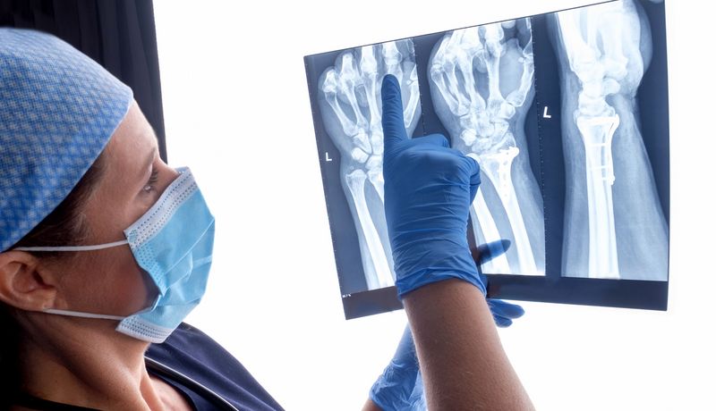 Ärztin, begutachtet Röntgenbild.