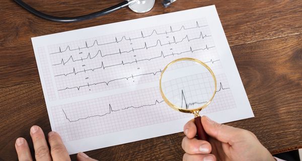 Blatt mit EKG-Kurven.