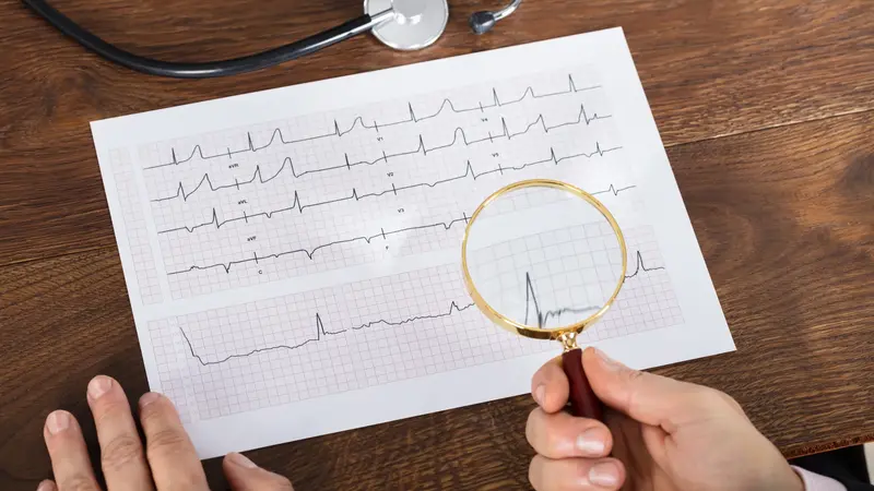 Blatt mit EKG-Kurven.