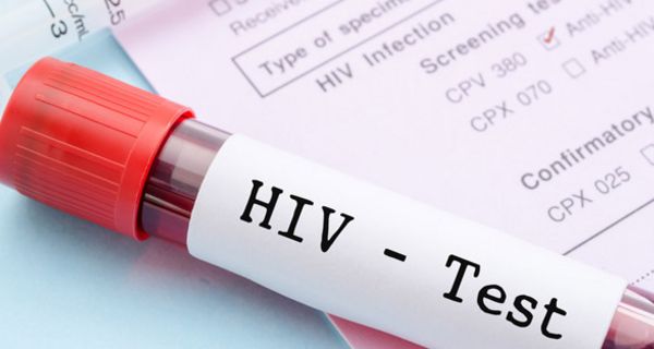In einigen Bundesländern gibt es deutlich mehr HIV-Infektionen als in anderen.