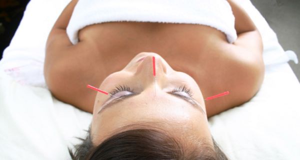 Akupunktur kann Verdauungsstörungen nachhaltig lindern.