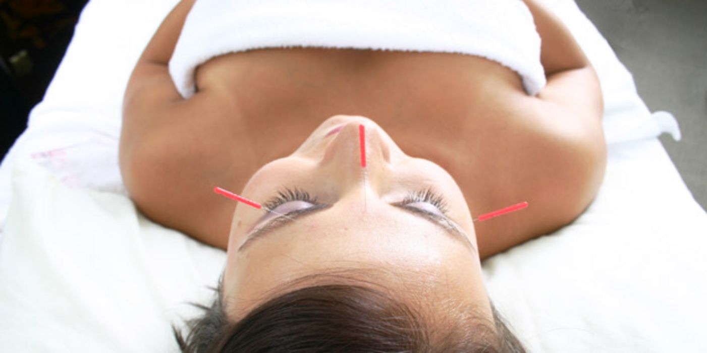 Akupunktur kann Verdauungsstörungen nachhaltig lindern.