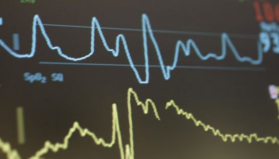 Anzeige eines medizinischen Geräts auf der Intensivstation
