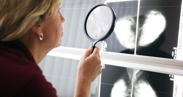 Diagnose Brustkrebs: Häufig werden falsche Befunde gemacht.