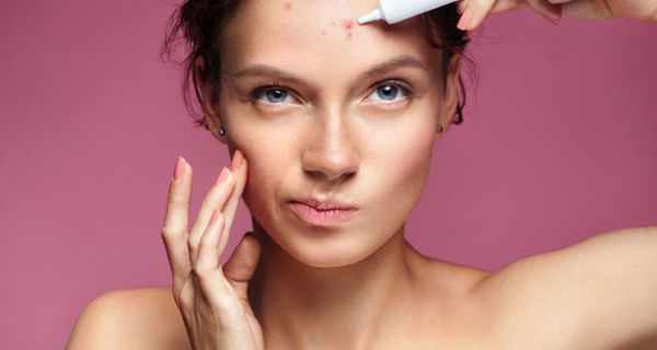 Acne comedonica und andere Arten lassen sich mit Medikamenten gut behandeln.