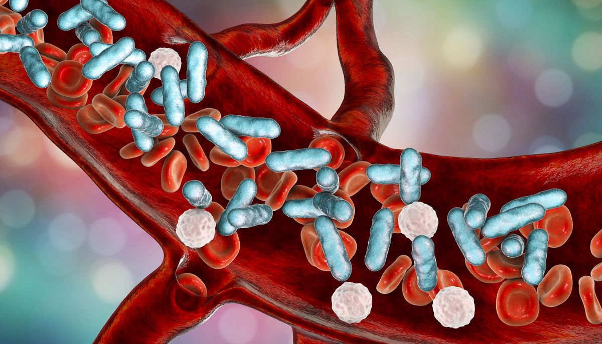 Notfall Sepsis: Wie lässt sich eine Blutvergiftung erkennen? | aponet.de