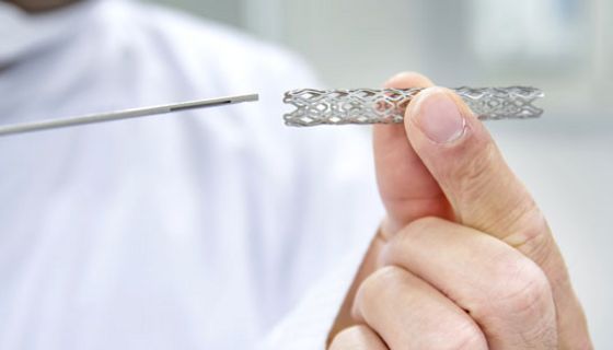 Mit einem Stent können verengten Bereiche offen gehalten werden. 