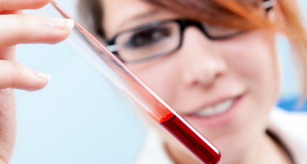 Großaufnahme Blutprobenröhrchen im Vordergrund, gehalten von Laborantin, rothaarig, dunkele Brille im Hintergrund (unscharf zu sehen), die lächelnd auf das Röhrchen schaut