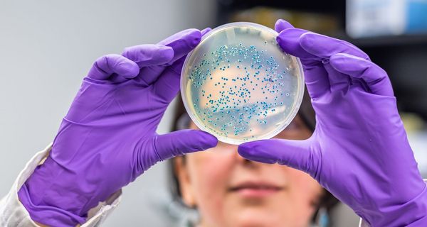 Eine Forscherin hält mit violetten Handschuhen eine Petrischale mit einer Bakterienkultur hoch.