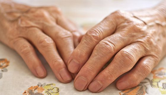 Arthritische Frauenhände auf einer Tischdecke
