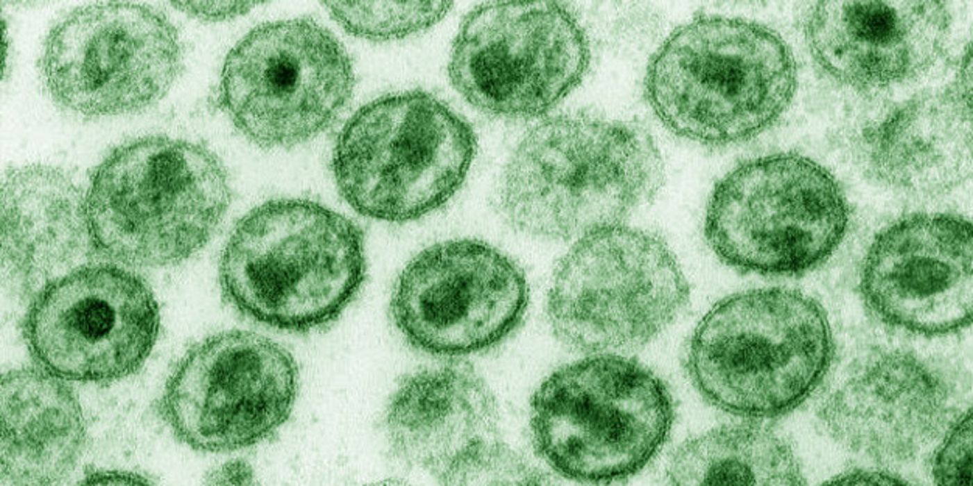 HI-Viren von der Art HIV-1 in einer elektronenmikroskopischen Aufnahme