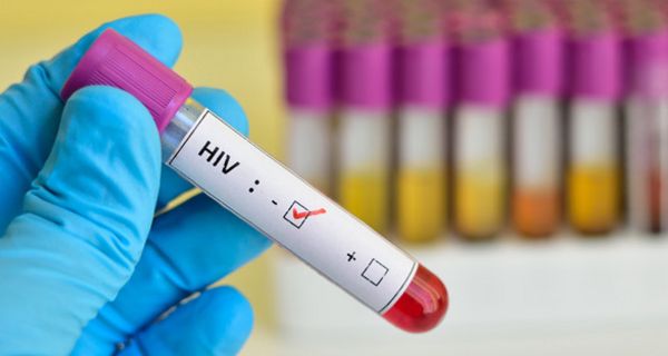 Späte HIV-Diagnose vergrößert die Ansteckungsgefahr. 