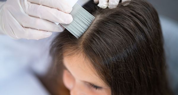 Die Haare eines dunkelhaarigen Mädchens werden mit einem Nissenkamm ausgekämmt.