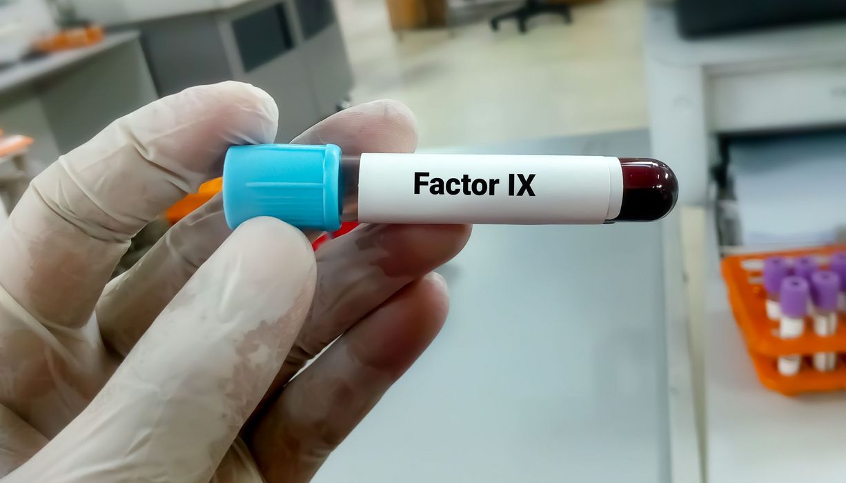 Mensch im Labor, hält eine Blutprobe mit der Beschriftung Faktor IX in die Kamera,