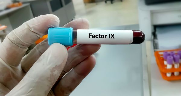 Mensch im Labor, hält eine Blutprobe mit der Beschriftung Faktor IX in die Kamera,