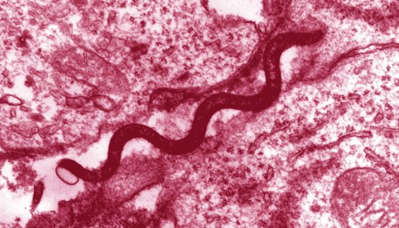 Die Syphilis wird durch eine Infektion mit Treponema pallidum, einem schraubenförmigen Stäbchenbakterium, verursacht. Diese Aufnahme entstand mit einem Elektronenmikroskop.