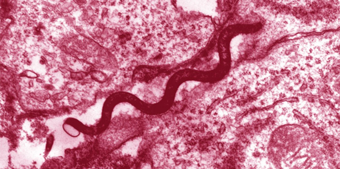 Die Syphilis wird durch eine Infektion mit Treponema pallidum, einem schraubenförmigen Stäbchenbakterium, verursacht. Diese Aufnahme entstand mit einem Elektronenmikroskop.