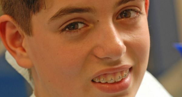 Junge mit Brackets