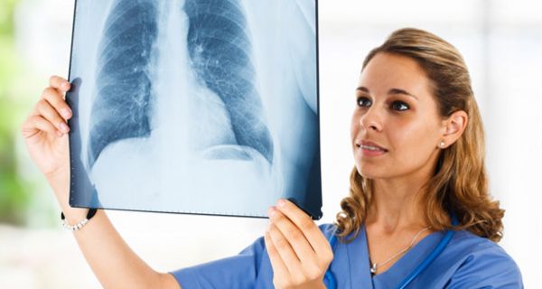 Ärztin betrachtet mit prüfendem Blick das Röntgenbild einer Lunge